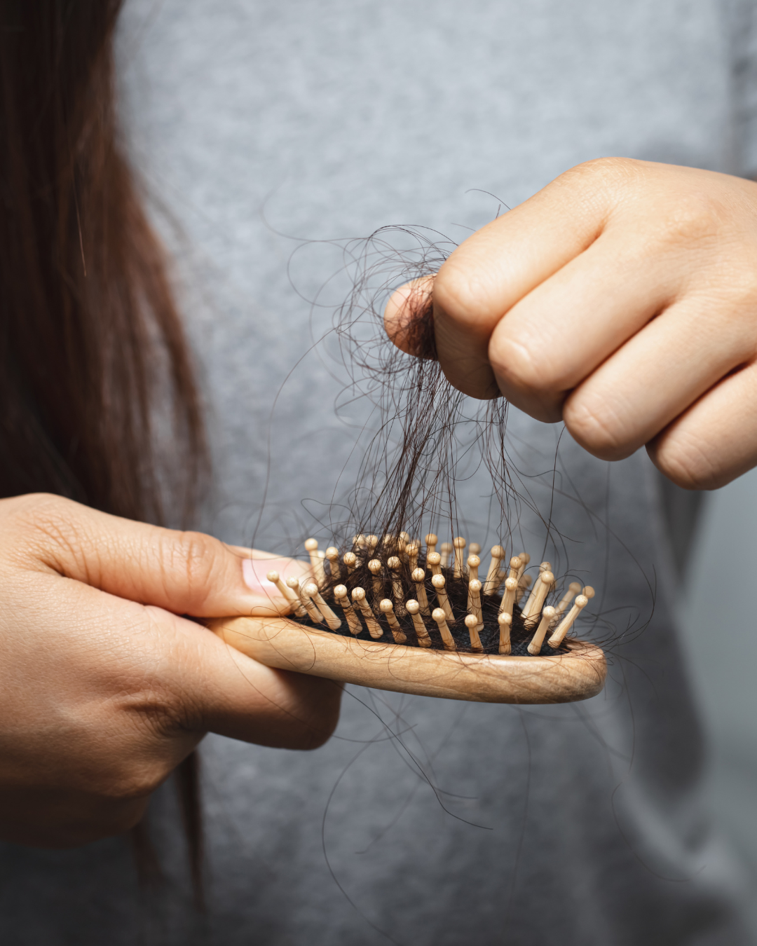 Insurance and Medical Wigs: What You Need to Know